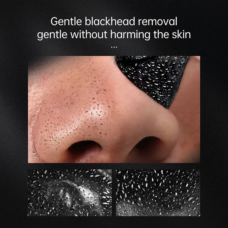 AUQUEST Blackhead Remover Black Dots Facial Masks NoseBamboo Charcoal Point Pimple Anti Acne Spot Face Skin Care Beauty Health - The Best Commerce
