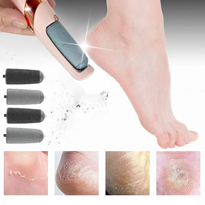 Soft Feet - Foot Crack Remover - The Best Commerce